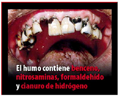 Imagen: /datos/imagenes/disp/2010/135/08826_001.png